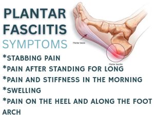 Read more about the article Plantar Fasciitis Symptoms