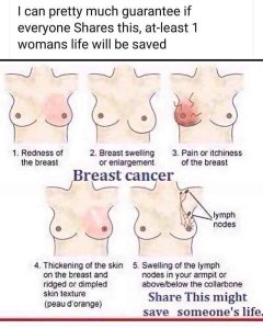 Read more about the article Breast Cancer